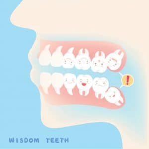wisdom teeth mcallen tx